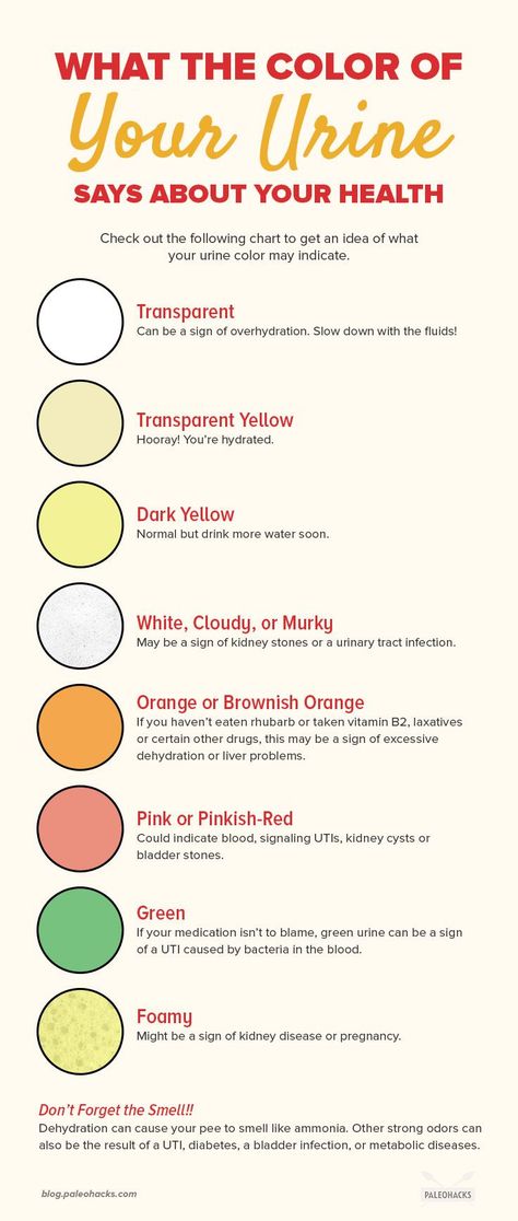 Has your urine been darker than usual? It may indicate simple dehydration, but a change in pee color could also mean something more. Read the full article here: https://paleo.co/urinecolor Pee Color, Color Of Urine, Urine Color, Coffin Nails Matte, Ginger Benefits, Natural Antibiotics, Easy Paleo, Pinterest Ideas, Medical Knowledge