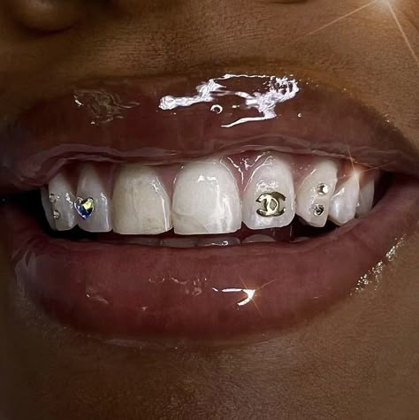 Teeth Bling, Teeth Jewels, Teeth Aesthetic, Teeth Gems, Pretty Teeth, Dental Jewelry, Grillz Teeth, Diamond Teeth, Grill Ideas