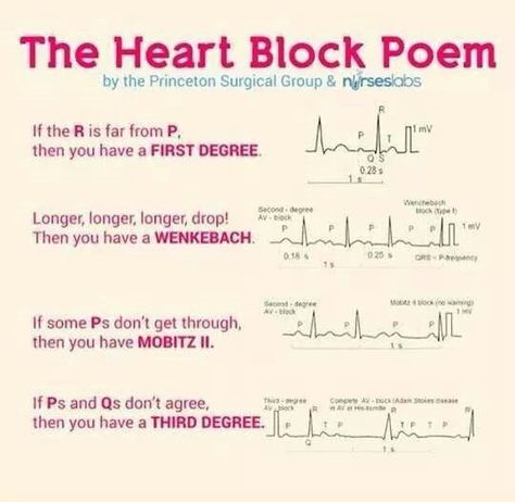 Heart Block song! Er Nursing, Physician Assistant Student, Ekg Interpretation, Paramedic School, Nursing Cheat, Nursing Mnemonics, Heart Blocks, Pa School, Cardiac Nursing