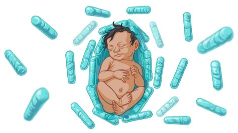 Sepsis Risk For Newborns Reduced By Probiotic Bacteria : Goats and Soda : NPR Probiotics For Men, Pregnancy Help, Probiotic Benefits, Best Probiotic, Bacterial Infection, Skin Diseases, Healthy Babies, Baby Health, Baby Feeding