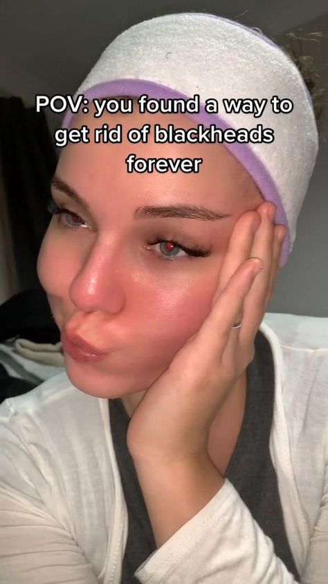 For Blackheads, Embrace Natural Beauty, Serious Skin Care, Good Skin Tips, For Healthy Skin, Clear Skin Tips, Healthy Skin Tips, Facial Skin Care Routine, Skin Care Routine Steps