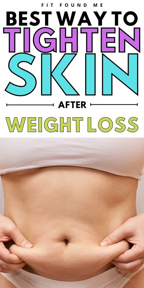 Loose Skin On Stomach, Loose Belly, Tighten Loose Skin, Tighten Skin, Excess Skin, Saggy Skin, Travel Plan, Loose Skin, Lose 50 Pounds