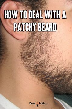 Right now your face has all the beard follicles it will ever need to grow a… Patchy Beard Styles, Patchy Beard, Beard Care Products, Beard Tips, Beard Man, Thick Beard, Bald With Beard, Beard Game, Perfect Beard