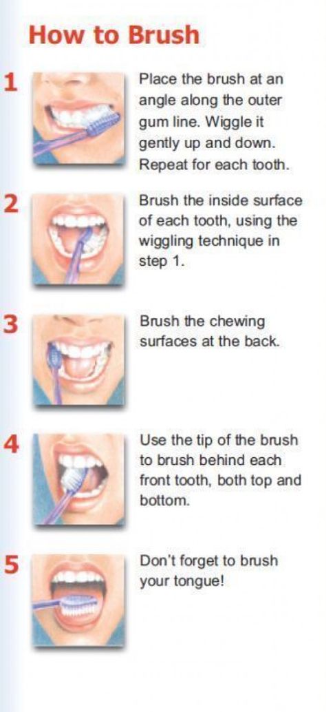 How to brush your teeth? Don't be surprised... We have to teach patients the proper technique everyday.  It is important to use proper technique using soft strokes and a soft bristle brush.  Harder is not better.  If you don't want recession that is!  Don't forget to massage the gums lightly and brush your tongue! #gumcare #gum #care #oral #hygiene Teeth Tips, Dental Posters, Dental Tips, Brushing Your Teeth, Brush Teeth, Brush Your Teeth, Sikat Gigi, Oral Care Routine, Gum Care