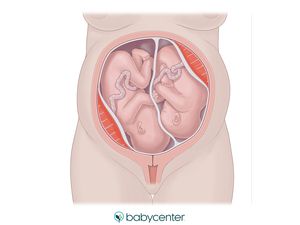 36 Weeks Pregnant Symptoms, Twins In The Womb, Last Week Of Pregnancy, Prenatal Development, Breech Babies, 24 Weeks Pregnant, Birth Videos, Pregnant With Twins, Fetal Position