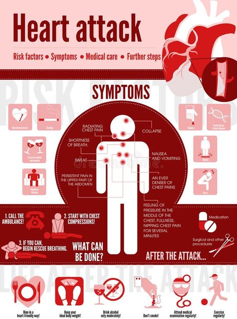 Illustration about Vector medical poster heart attack. Symptoms of the disease. Prevention. Illustration of cute sick girl. Illustration of cardiology, disease, cute - 159007627 Heart Infographic, Disease Infographic, Foot Reflexology Massage, Healthy Heart Tips, World Heart Day, Medical Posters, Health Guru, Health Signs, Infographic Poster