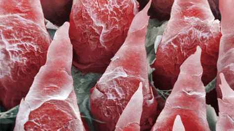 A high energy beam scanner, called a scanning electron micrograph, was used to capture this image, which shows the surface of a human tongue. The protruding objects, called filiform papillae, can sense pressure. The flaky appearance of the papillae results from the fact that they are constantly shedding their skin to increase sensitivity. Human Tongue, Electron Microscope Images, Scanning Electron Microscope, Scanning Electron Micrograph, Microscopic Photography, Micro Photography, Microscopic Images, Electron Microscope, Microscopes