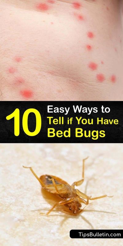 Bed Bug Bites Pictures, Bed Bug Trap, Signs Of Bed Bugs, Get Rid Of Bed Bugs, Bug Trap, Easy Juice Recipes, Kill Bed Bugs, Vegan Probiotics, Adult Bed