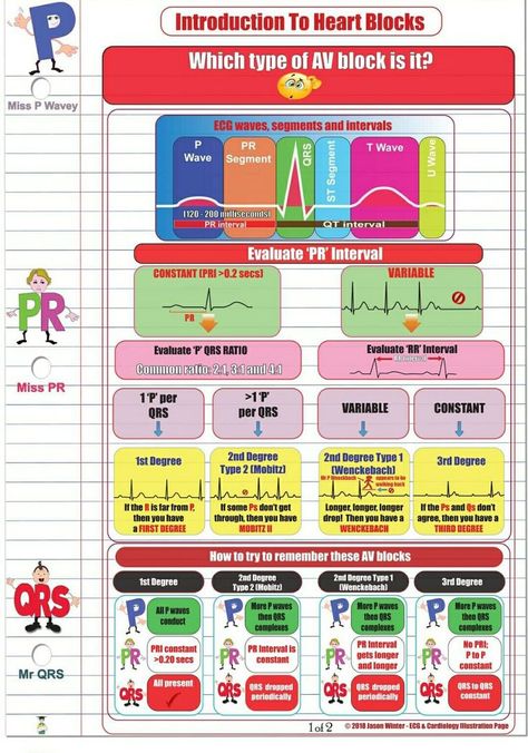 Intro to Heart Blocks Nursing Cardiac, Nurse Brain Sheet, Nursing Flashcards, Cardiology Nursing, Ekg Interpretation, Type Of People, Nursing Mnemonics, Heart Blocks, Cardiac Nursing