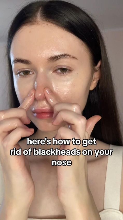 "✨ Blackhead Banishment 101: Unveil Your Clear Skin Secrets! 🌟💆‍♀️ Dive into a world of radiancy. Natural Beauty Face, Blackhead Remedies, Blackheads On Nose, Bad Acne, Rid Of Blackheads, Beauty Routine Tips, Natural Sleep Remedies, Get Rid Of Blackheads, Beauty Face Women