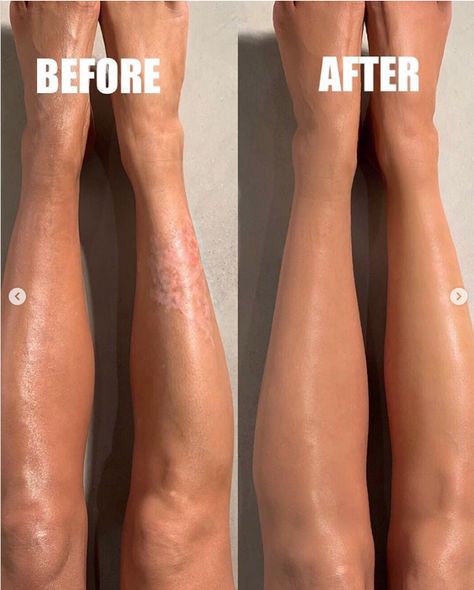 Best Body Makeup, Body Makeup For Legs Products, Leg Makeup For Veins Cover Up, Under Arm Waxing, Design Essentials Hair Products, Arm Waxing, Huge Blackheads, Body Blur, Ear Pimple