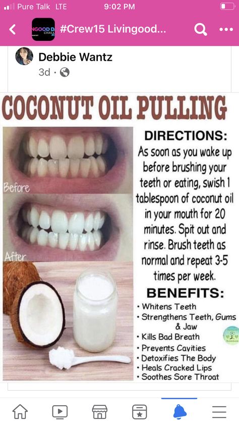 Coconut Oil Pulling Benefits, Oil Pulling Benefits, Teeth Whitening Homemade, Strong Teeth, Teeth Whitening Remedies, Strengthen Teeth, Teeth Whitening Diy, Resep Diet, Coconut Oil Pulling