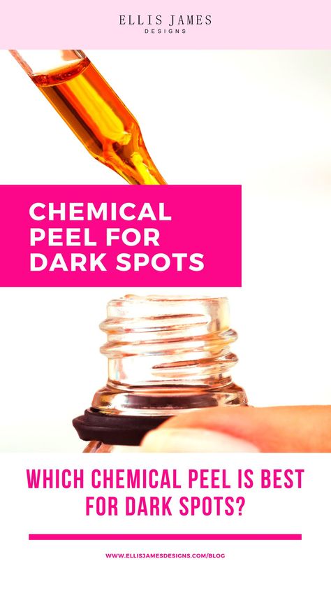 In this post, let's learn more about using a chemical peel for dark spots and share our top picks for the best chemical peels to try. | Chemical Peel for Dark Spots | Best Chemical Peel for Dark Spots | Is a chemical peel good for dark spots? | Should I get a chemical peel for dark spots? | Which chemical peel is best for dark spots? | Which chemical peel is good for dark spots on women of color? | How long does it take for dark spots to fade? | #DarkSpots #DarkSpotsTreatment #ChemicalPeeling #C Best Chemical Peel, The Ordinary Peeling Solution, Dark Spot Remover For Face, Chemical Peel At Home, Laser Resurfacing, Acid Peel, Home Tricks, Face Peel, Dark Spots On Face