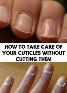 Nails Care, Milky Nails, Cuticle Care, How To Grow Nails, Nail Care Routine, Nail Care Tips, Brittle Nails, Nail Growth, Pregnancy Health