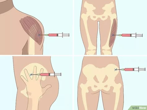 blood is aspirated, then the medication can be pus Medical Prints, Medications Nursing, Medical Assistant Student, B12 Injections, Feeling Sluggish, Medical School Life, Nursing School Motivation, Nursing Student Tips, B12 Deficiency