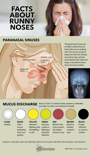 Diagram of sinuses and chart of mucus colors. Mucus Color, Paranasal Sinuses, Sinus Infection, Medical Knowledge, Runny Nose, Health Plan, Health Facts, Health Advice, Health Info