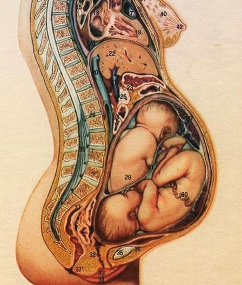 Entwined Art, Pregnant Anatomy, Twin Pregnancy Symptoms, Pregnancy Anatomy, Twin Belly, Twin Pregnancy Belly, Twin Mum, Pregnancy Ultrasound, Twin Pregnancy Announcement