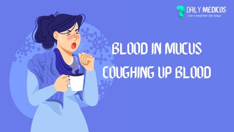 The medical term for coughing up blood is haemoptysis. One mighty cough out small amounts of red blood, or frothy blood-streaked sputum (phlegm). Blood in mucus can show a number of possible diseases How To Clear Mucus From Chest, How To Clear Mucus From Lungs, How To Expel Mucus, Coughing Up Blood, Herbs For Mucus Lungs, How To Cough Up Mucus Chest Congestion, Fluid In Lungs, Severe Cough, Productive Cough