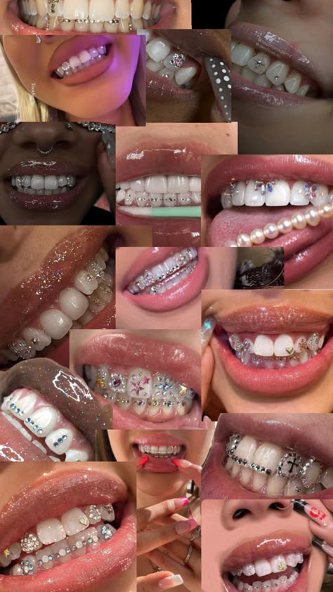 Bijoux Piercing Septum, Trippy Tattoo Designs, Trippy Tattoo, Teeth Gems, Pretty Teeth, Dental Jewelry, Grillz Teeth, Xoxo Jewelry, Cute Braces