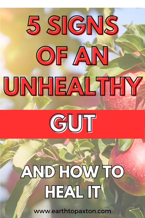 Foods to Heal Leaky Gut | Gut Health Diet | Leaky Gut Symptoms Natural Remedies |   Gut Healing Diet | Leaky Gut Remedies How To Naturally Heal Your Gut, Clean Out Your Gut, What Is Gut Health, Healing Gut Foods, Best Diet For Gut Health, Ways To Heal Your Gut, Foods Bad For Gut Health, How To Fix Your Gut, Slow Digestion Remedy