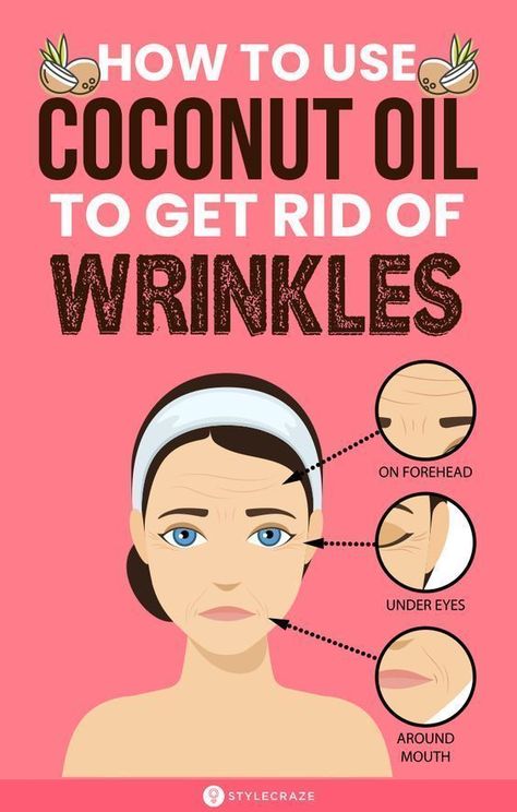 Wrinkles Remedies Face, Camouflage Makeup, Get Rid Of Wrinkles, Wrinkle Remedies, Ootd Instagram, Skin Care Wrinkles, Baking Soda Shampoo, Coconut Oil For Skin, Face Wrinkles