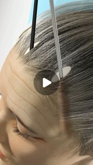 𝗨𝗻𝗯𝗶𝗮𝘀𝗲𝗱 𝗜𝗻𝗳𝗼 𝗔𝗯𝗼𝘂𝘁 𝗣𝗹𝗮𝘀𝘁𝗶𝗰 𝗦𝘂𝗿𝗴𝗲𝗿𝘆 on Instagram: "What is this procedure? Write in the comments...

Have you undergone this or a similar procedure? Share your experience to help others make informed decisions. If you haven't, share this story with someone who has, and together, help others get the knowledge they need. Click the link in our bio to join the discussion!

Video credit: Amerra Medical" Procedural Writing, Cosmetic Procedures, Video Credits, Help Others, A Plus, Plastic Surgery, Helping Others, Surgery, Click The Link