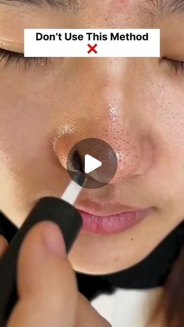 Black And White Heads Removal, How To Remove Blackheads From Face, How To Remove Black Heads, How To Remove Blackheads From Nose, White Heads Removal Remedies, Black Heads On Nose, White Head Removal, Diy Blackheads Removal, How To Get Rid Of Blackheads