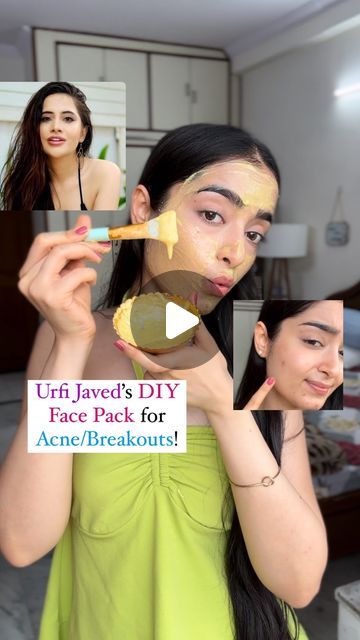 Besan Face Mask Glowing Skin, Curd Face Mask, Honey And Lemon Face Mask, Diy Face Mask For Acne, Urfi Javed, Face Mask For Acne, Lemon Face Mask, Mask For Acne, Body Acne