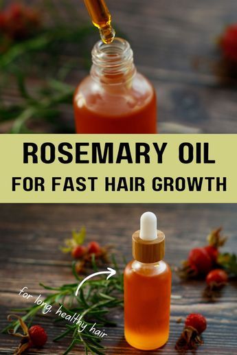 Boost hair growth and prevent hair loss with this DIY Rosemary and Rosehip Oil for hair! It’s easy to make at home, just needs 2 ingredients and only a couple of minutes of your time. Address common hair concerns by adding this homemade hair oil to your natural hair care routine. Nourish your precious mane from the roots to the tips, and simultaneously, you take care of your scalp health (especially if you have a dry scalp). Rosehip promotes hair thickness, faster hair growth, healthy hair, shiny hair. Homemade oil with either fresh or dried rosemary, or rosemary essential oil. Homemade Hair Care DIY recipes Homemade Rosemary Hair Oil, Diy Rosemary Oil For Hair, Rosemary Oil For Hair Growth Diy, Rosehip Oil For Hair, Rosemary For Hair, Hair Growth Oil Recipe, Homemade Hair Oil, Hair Oil Recipe, Diy Hair Oil