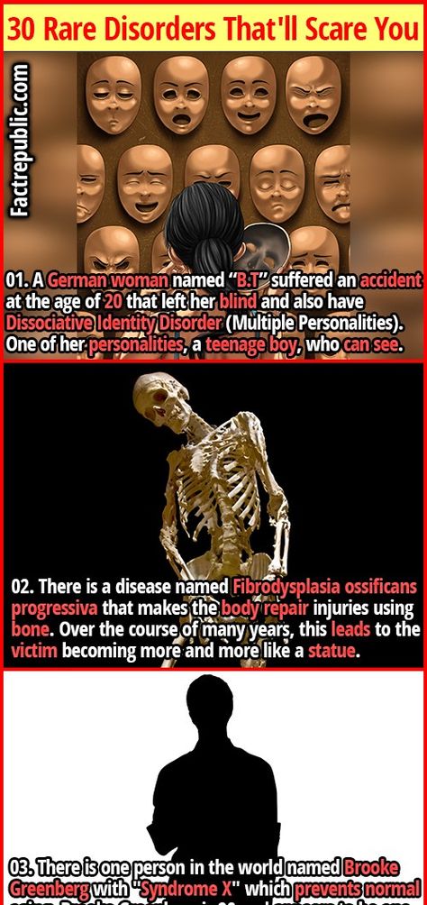 Paranormal Facts, World History Facts, Short Creepy Stories, Wierd Facts, Rare Genetic Disorders, Rare Disorders, Fact Republic, True Interesting Facts, Cool Science Facts