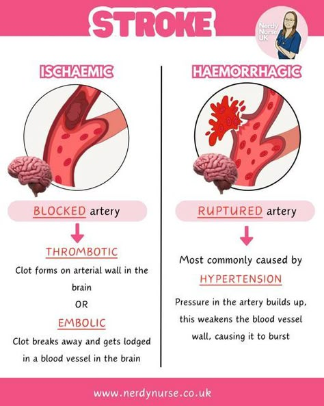 Lauren - Nursing made easy on Instagram: "Ischaemic vs haemorrhagic stroke  A very simple overview  #nursingclinicals #pathophysiologyclass #pathophysiologynotes #nursingstudentsofinstagram #studentnursestudytips #nursingstudentnotes #studentnurses #futurenurses #nursingresources #nurseintraining #nurseinprogress #adultnursing #nursetobe #nursingassociates #traineenursingassociates #traineenursingassociate #studentparamedicuk #studentparamedicsuk #studynursing #studentnurseuk #studentnurse #nursingnotes #nursingschool #nursingstudent #studentnursesofinstagram #studentparamedic #pathophysiology" Nursing Finals, Biology Topics, Med Surge, Lpn Student, Pathophysiology Nursing, Study Tricks, What Is Intelligence, Ipad Pro Notes, Bsc Nursing