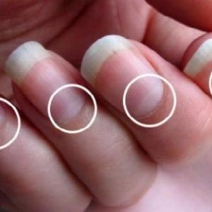 Moons On Fingernails, Nail Health Signs, Fingernail Health, Almond Blue Nails, White Toes Nail, Jumper Nails, Half Moon Nails, Flame Nails, Nail Room Ideas