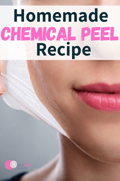 Mary Kay Facial Peel, Homemade Face Peel, Diy Facial Peel, Chemical Peel Benefits, Diy Chemical Peel, At Home Chemical Peel, Nose Peeling, Diy Peel Off Mask, Best Chemical Peel