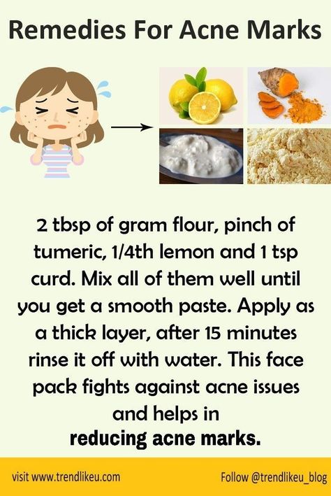 Remedies For Acne, Remedies For Glowing Skin, Ingrown Toenail, Skin Face Mask, Clear Skin Face, Clear Healthy Skin, Natural Face Skin Care, Acne Skincare Routine, Natural Acne Remedies