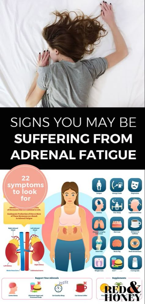 Adrenal Fatigue Symptoms Signs, Symptoms Of Adrenal Fatigue, Low Thyroid Remedies, Adrenal Fatigue Diet, Thyroid Remedies, Adrenal Fatigue Symptoms, Adrenal Gland, Fatigue Symptoms, Low Estrogen Symptoms