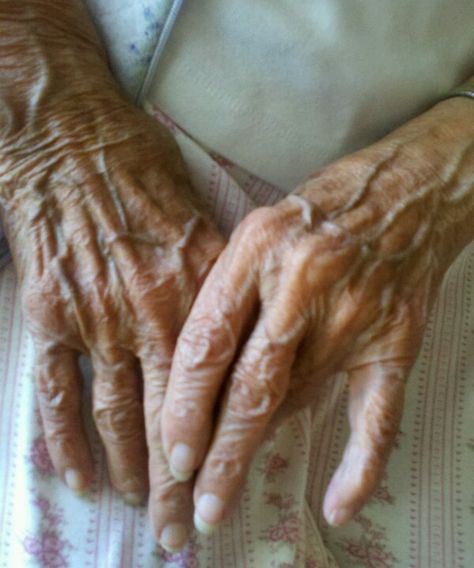 Hands say so much about ones life... this 95 year old woman has taught me so much Old Person Aesthetic, Wrinkles Hands, Hand Photography, Old Person, Wrinkled Skin, Old Hands, Old Woman, Ap Art, Old Age