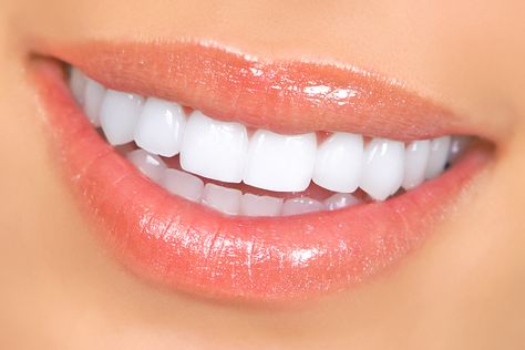 Affirmation: My teeth are straight, pearly white, strong, clean & healthy. Whiten Whites, Teeth Whitening Remedies, Pasta Dental, Whiten Teeth, Yellow Teeth, Teeth Whitening Strips, Best Teeth Whitening, Natural Teeth Whitening, Natural Teeth