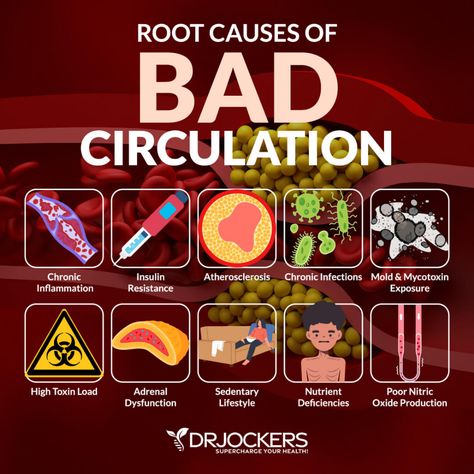 Bad Circulation In Legs Symptoms, Poor Circulation Symptoms, Blood Circulation Diagram, Improve Leg Circulation, Bad Circulation, Insulin Resistant, Leg Circulation, Poor Circulation, Toxic Free