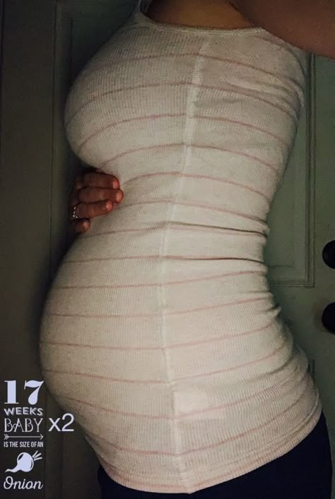 17 weeks pregnant with twins Pregnant Twins Belly, Twin Pregnant Belly, Twin Pregnancy Aesthetic, 5 Month Pregnant Belly, 17 Weeks Pregnant Belly, Pregnant With Twins Belly, 5 Months Pregnant Belly, Pregnant With Twins, 15 Weeks Pregnant Belly