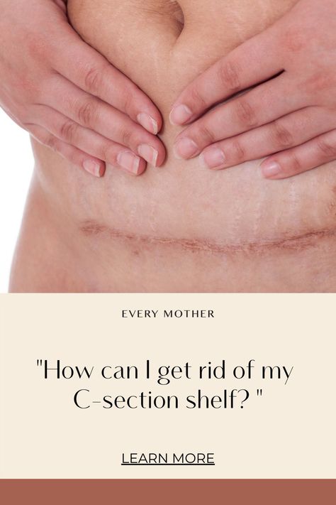 After C Section Workout, C Section Workout, Post C Section, C Section Scars, Diastasis Recti Exercises, Fitness Influencer, C Section Recovery, Post Pregnancy Workout, Baby Workout