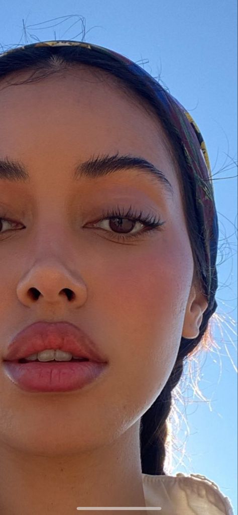 Cindy Kimberly Lip Fillers, Button Nose Surgery, Keyhole Pout Lip Filler, Front Nose Profile, Small Slim Nose, Big Pouty Lips, Lip Filler Pouty Lips, Keyhole Pout Lips, Big Nose Small Lips