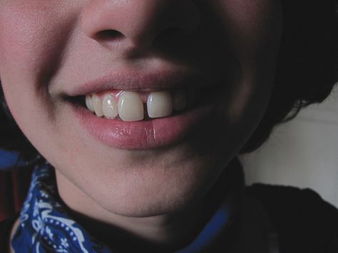 TEETH | Flickr - Photo Sharing! Buck Teeth Aesthetic, Gap Teeth Aesthetic, Messed Up Teeth, Teeth Gaps Aesthetic, Twisted Transistor, Character Eyes, Animal Crossing Cats, Teeth Gap, Blood Meridian