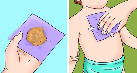 6 Signs Your Body Is Producing Excessive Mucus and How to Stop It / Bright Side Honey Wrap, Getting Rid Of Mucus, Ginger Wraps, Severe Cough, Cold And Cough, Persistent Cough, Cough Relief, Cold And Cough Remedies, Turmeric Milk