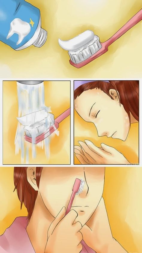 Remove blackheads from your skin by toothbrush and toothpaste Toothbrush And Toothpaste, Remove Blackheads, Get Rid Of Blackheads, Lose 40 Pounds, Skin Issues, Blackhead Remover, Skin Conditions, Facial Care, Brushing