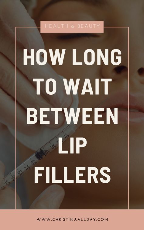 Lip fillers are a popular cosmetic procedure that can be used to plump up the lips and create a more youthful appearance. I’ve had it done at Sanctuary Medical Center in Boca Raton a few times and my sister is obsessed with the work Liz does there. However, it’s important to know how long to wait between lip filler treatments in order to avoid any complications. Perfect Lip Filler Shape, How Long Does Lip Filler Last, 2 Ml Lip Filler, Different Lip Filler Shapes, Light Lip Filler, .5 Lip Filler, Lip Filler On Small Lips, 0.5ml Lip Filler Before And After, Lips With Filler