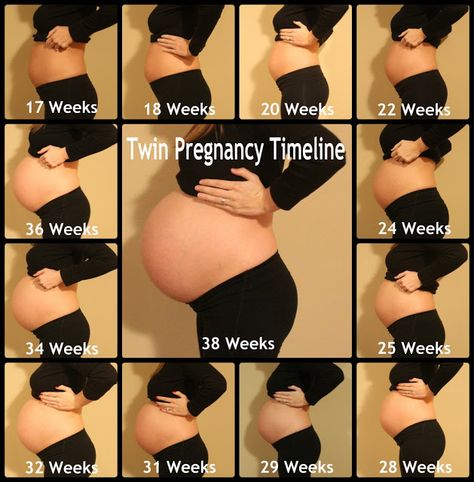 Pregnancy Belly Growth, Twin Belly, Twin Pregnancy Belly, Bump Progression, Baby Bump Progression, Pregnancy Chart, Pregnancy Timeline, Having Twins, Belly Photos