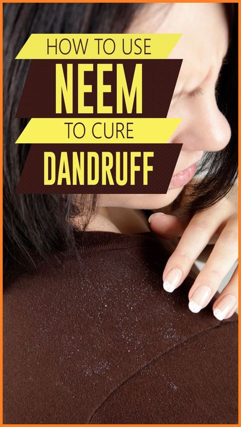 Bonus Tip: Incorporate a balanced diet to promote hair growth. #hairgrowth #hair #hairfall Neem Hair Mask, Hair Masks For Dandruff, Haircare Dandruff, How To Remove Dandruff, Hair Mask For Dandruff, Baking Soda And Honey, Neem Leaves, Home Remedies For Dandruff, Dandruff Hair