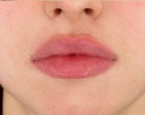 Lips Inspiration, Lips Photo, Beauty Goals, Perfect Lips, Nose Job, Lip Fillers, Dream Body, Cute Makeup, Beauty Face