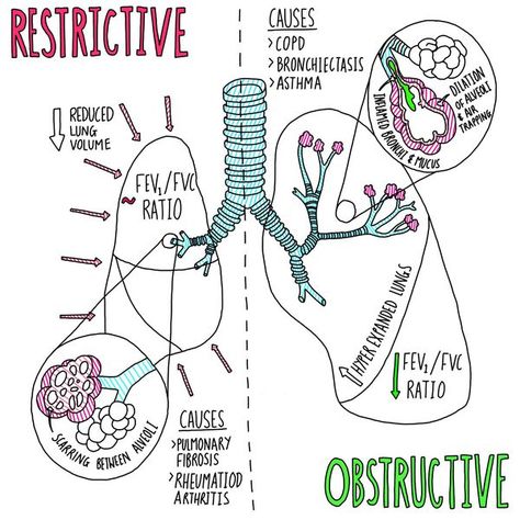 Image result for restrictive vs obstructive lung diseases Lungs Notes, Respiratory Therapy Notes, Respiratory Therapist Student, Respiratory Therapy Student, Medical Student Study, Nursing School Survival, Pulmonology, Respiratory Care, Respiratory Therapy