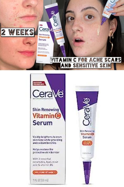 Cerave Vitamin C Serum, Serum For Face, Skin Serum, Vitamin C Serum, Brightening Serum, Ascorbic Acid, Protective Packaging, Even Skin Tone, Fragrance Free